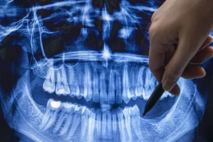 Stamotologiyada İNQİLAB: Yeni diş çıxması üçün DƏRMAN